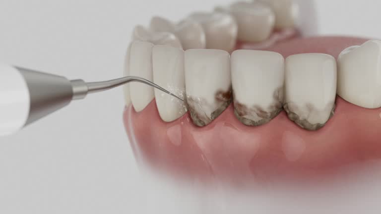 Trusted Teeth Cleaning And Checkup service in Comstock Park, MI - Dentist Open Now